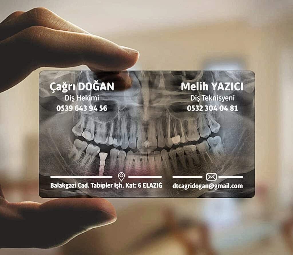 Diş Hekimi Şeffaf Kartvizit 1024x890 - Şeffaf Kartvizit